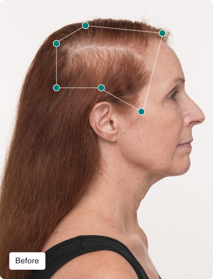 Nutrafol Hairbiotic Hair Growth Treatments & Supplements Nutrafol