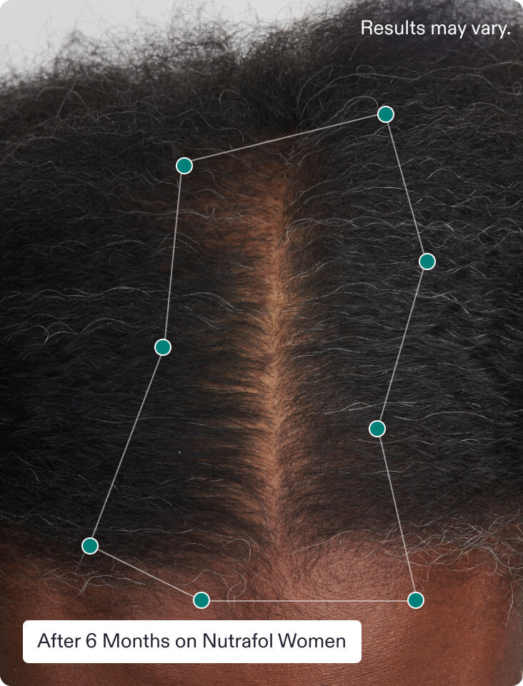 Nutrafol Stress Adaptogen Hair Growth Treatments & Supplements Nutrafol