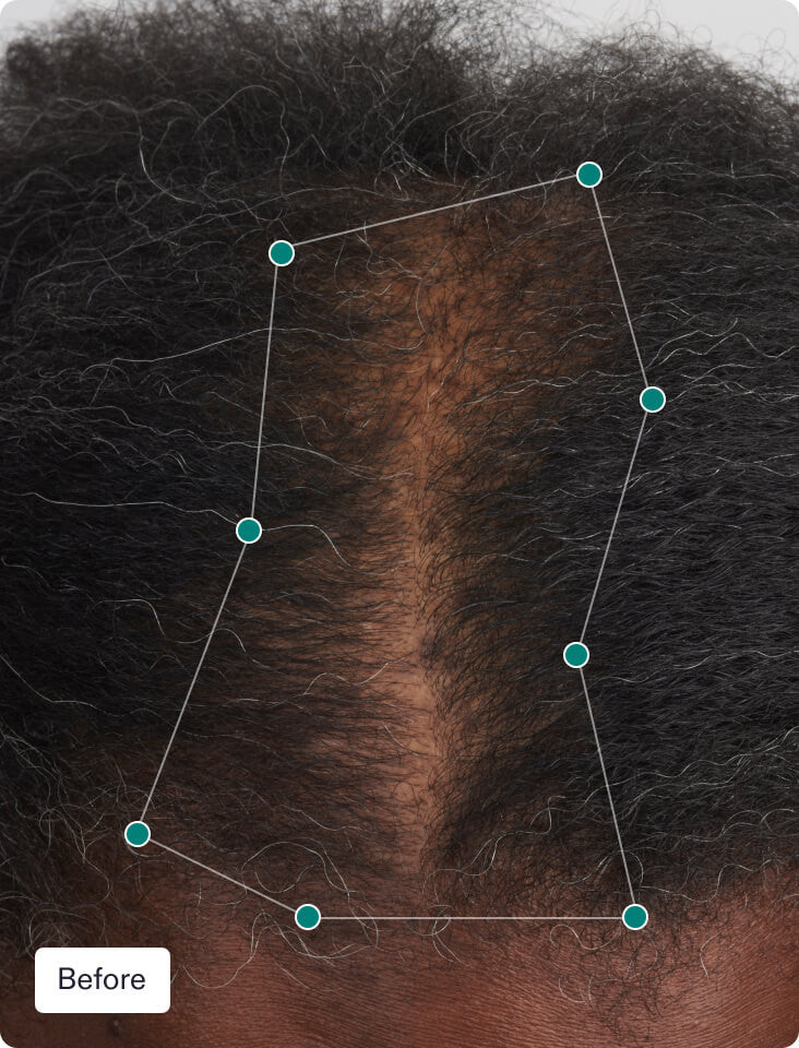 Nutrafol Stress Adaptogen Hair Growth Treatments & Supplements Nutrafol