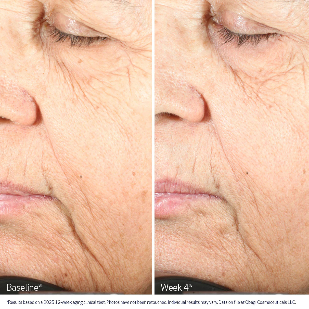 Obagi NU-GEN™ Cellular Renewal Serum