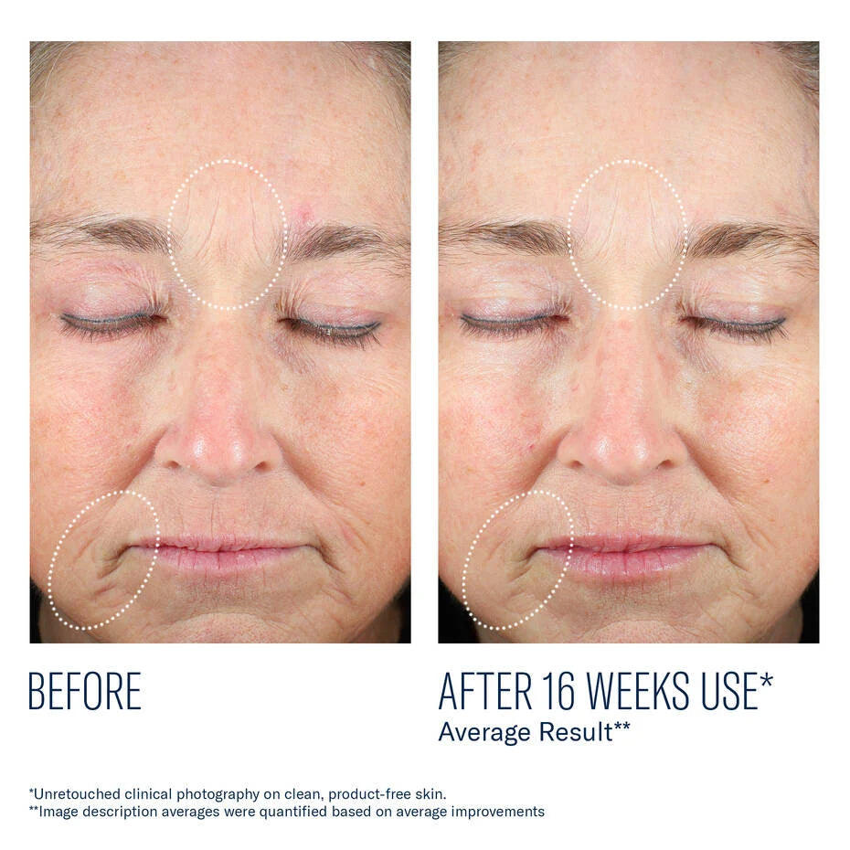 Skinbetter Science Mystro Revive Renewing Serum