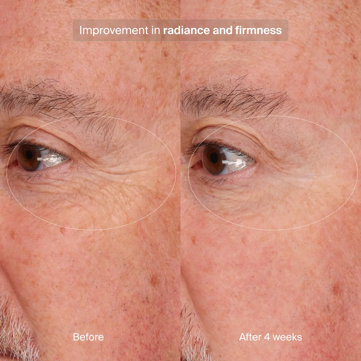 Pavise Precision Eye Lift