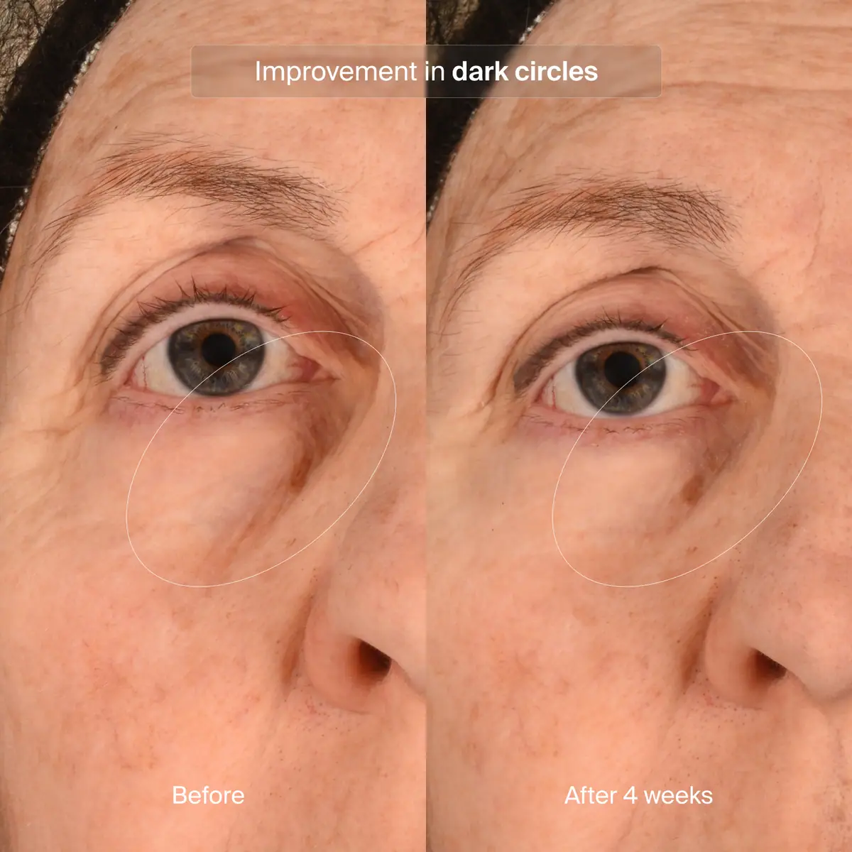 Pavise Precision Eye Lift