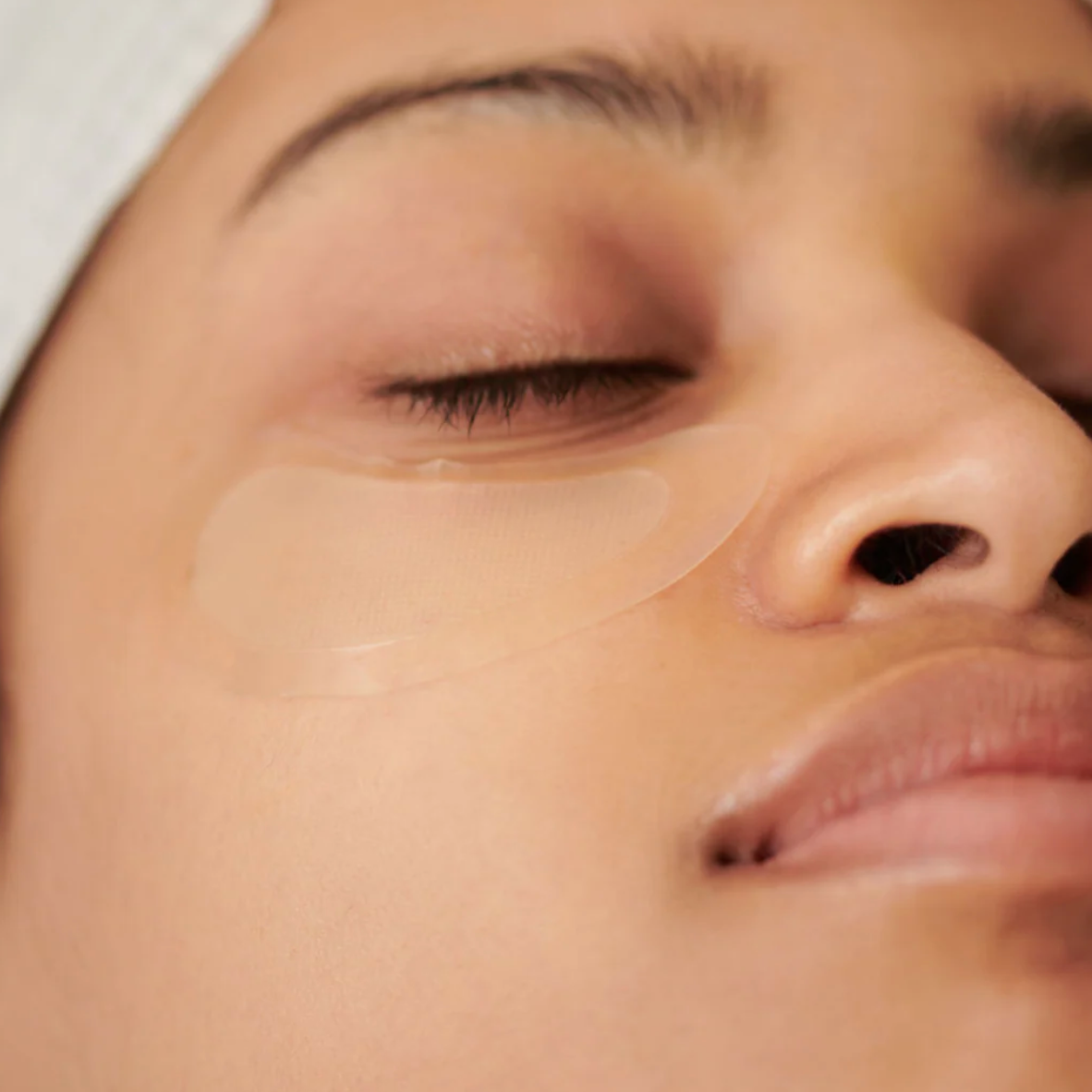 KrX Aesthetics Undereye Darts