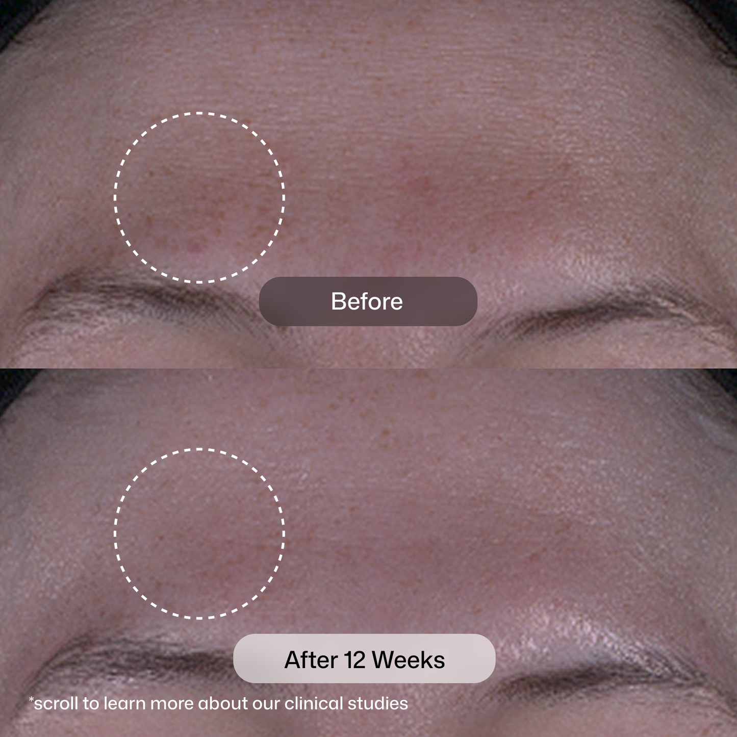 Revision Skincare Tone+ Correcting Pads