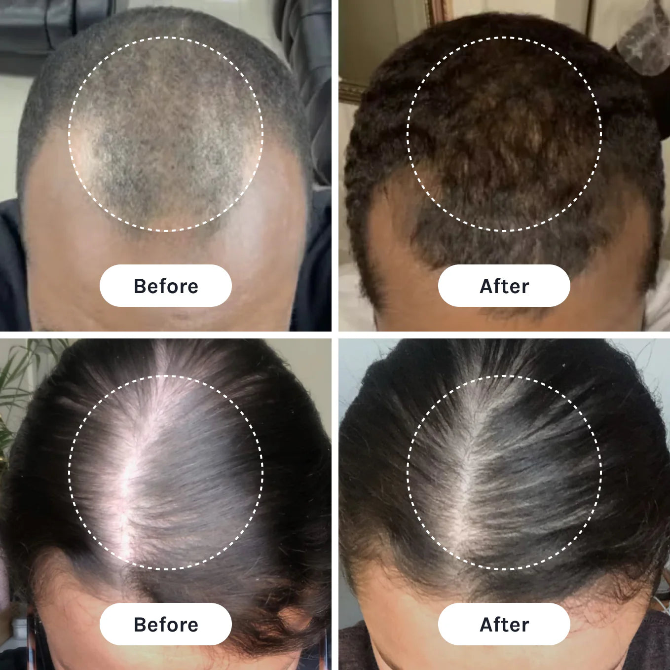 InfiniWell Duo | Hair Nourishment