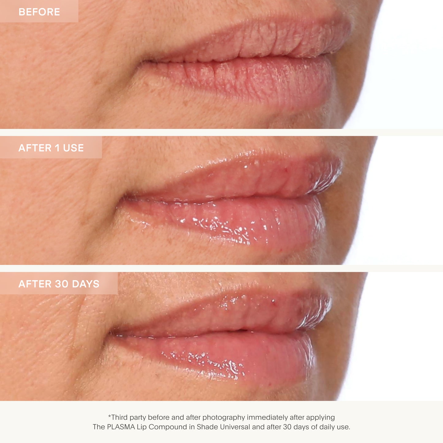 U Beauty The PLASMA Lip Compound