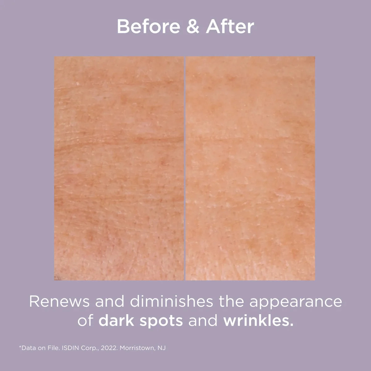 ISDIN Isdinceutics Glicoisdin 25 Intense Serums & Treatments ISDIN