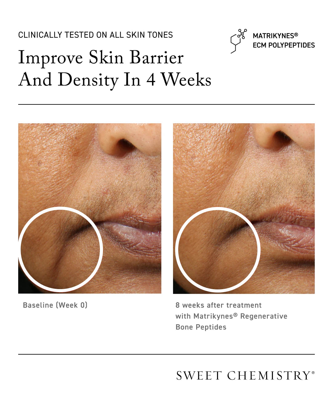 Sweet Chemistry Elasticity Reinforcing Lipid-Cream