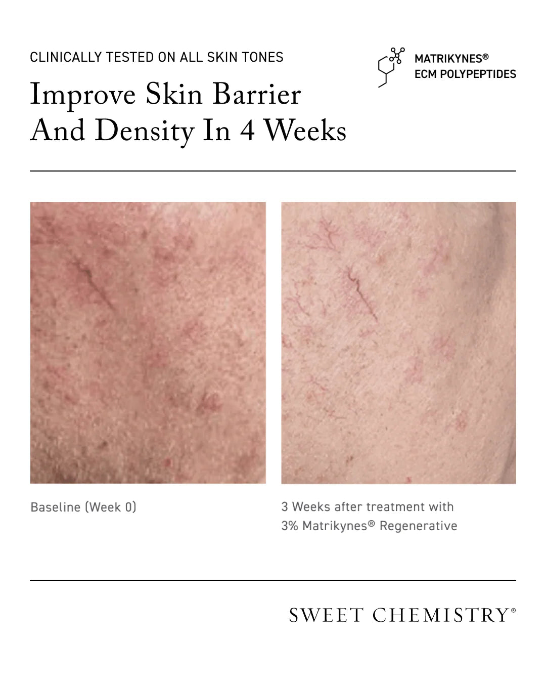 Sweet Chemistry Barrier Repairing Hydra-Serum