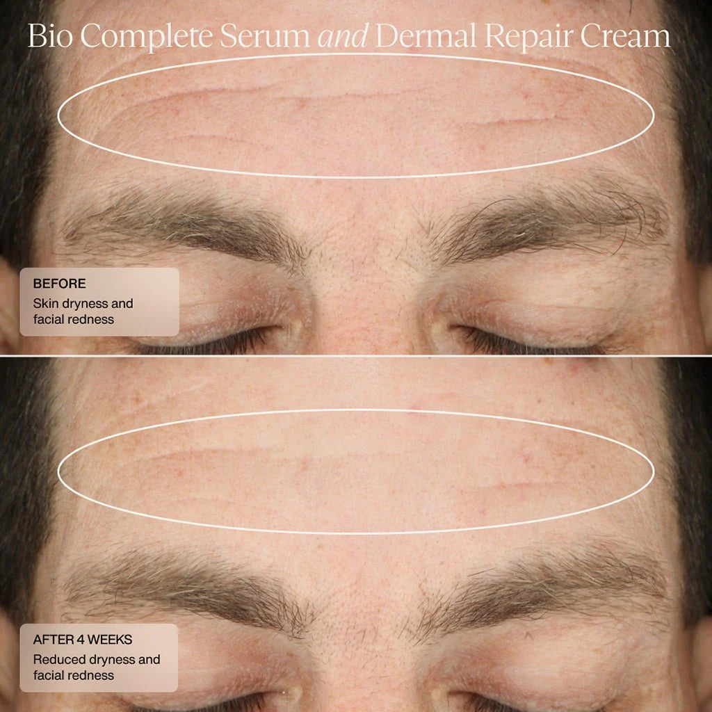 Senté Bio Complete Serum Serums & Treatments Senté