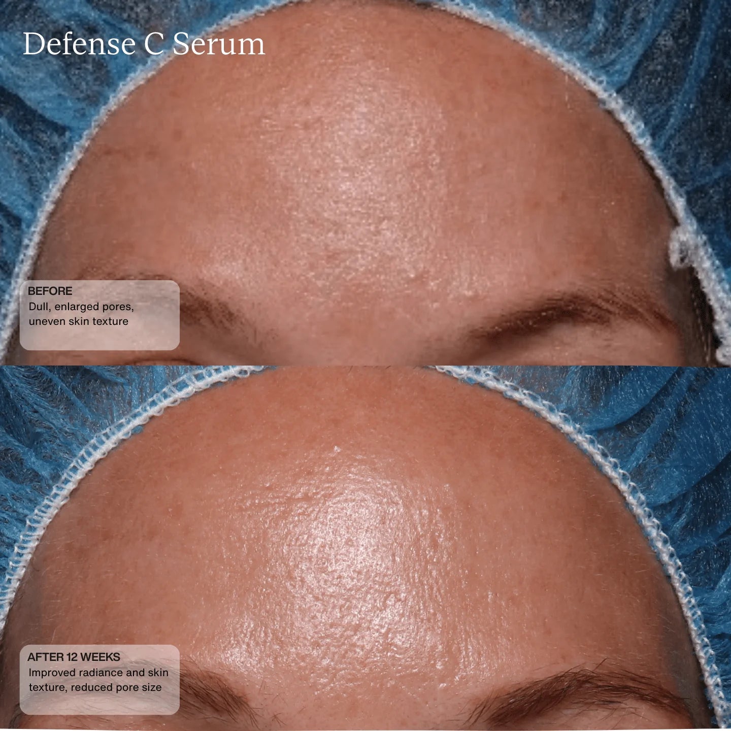 Senté Defense C Serum