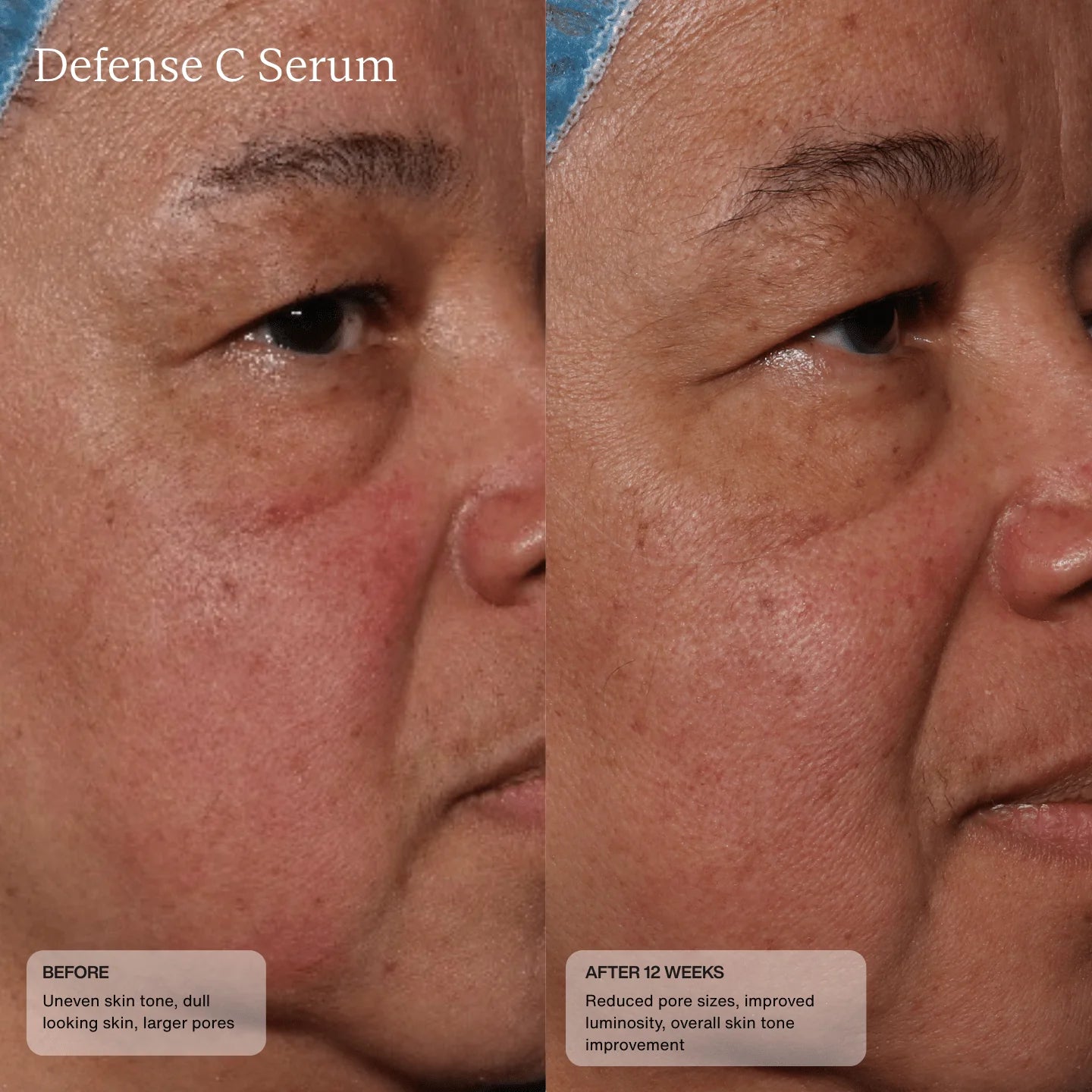 Senté Defense C Serum