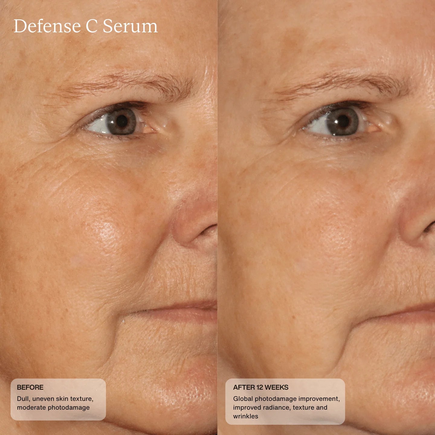 Senté Defense C Serum