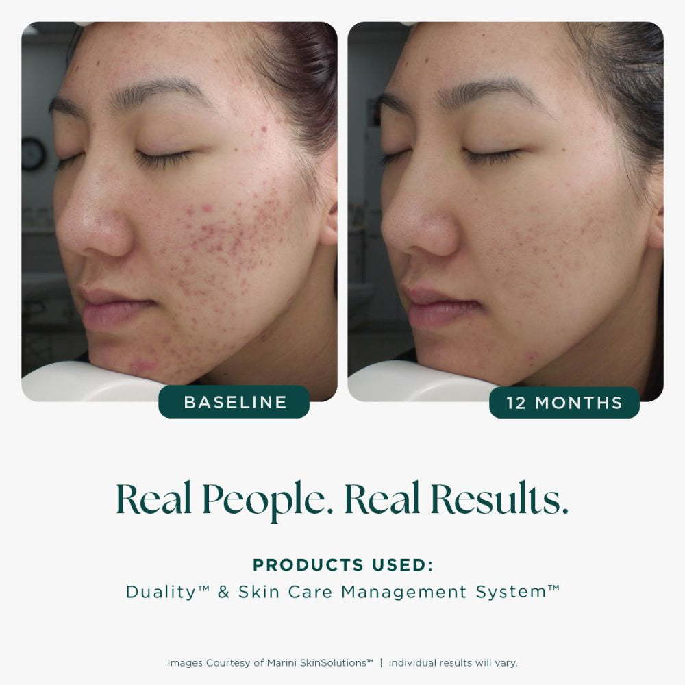 Jan Marini Age Intervention Duality | Skin Truth