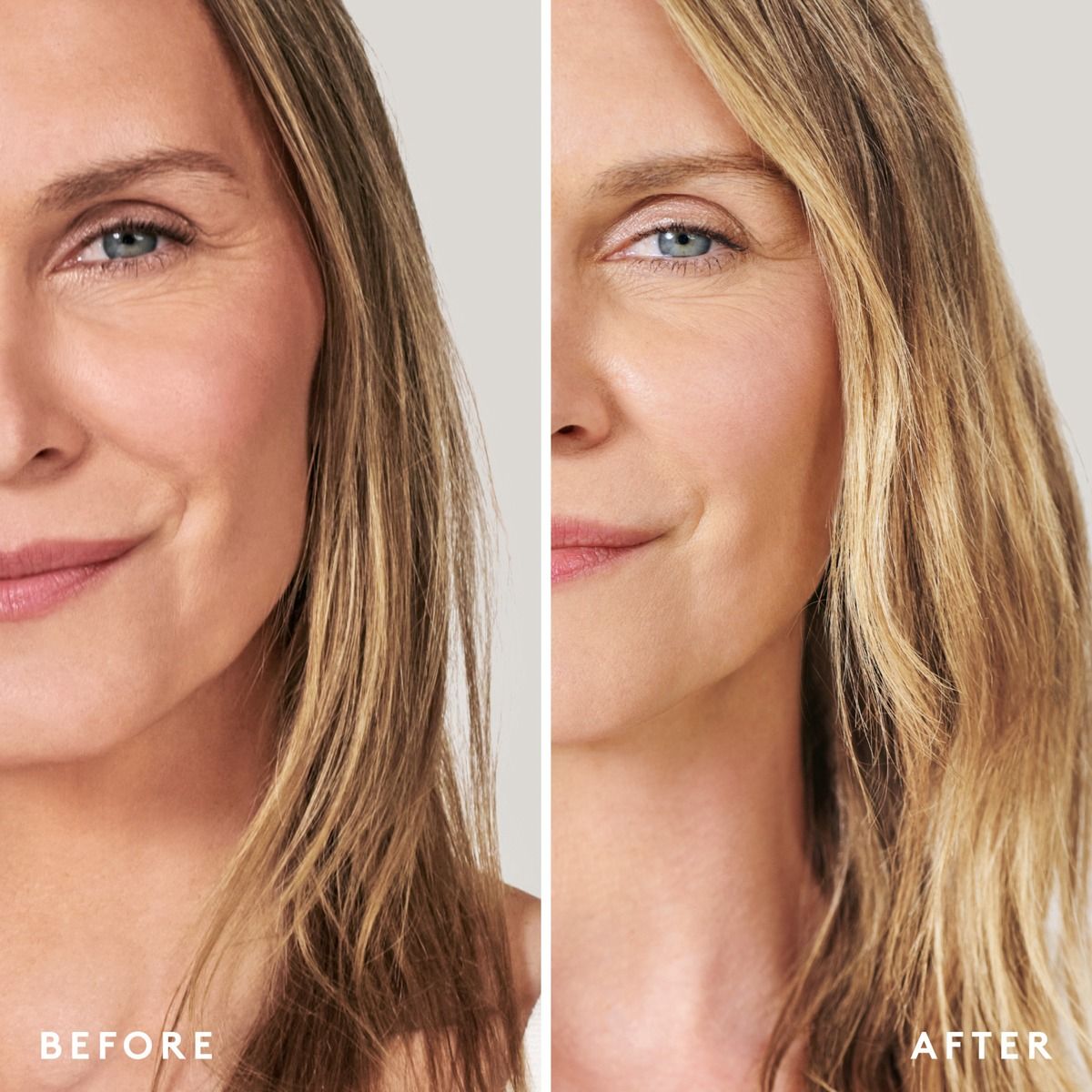 Before and after comparison of a woman's face with visible hair improvement.