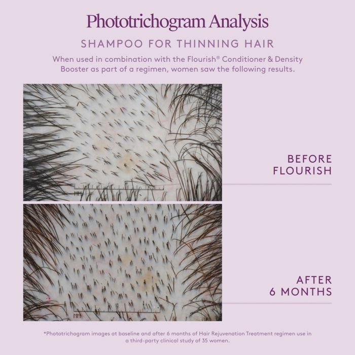 Phototrichogram analysis of shampoo for thinning hair before and after 6 months of use with Flourish.