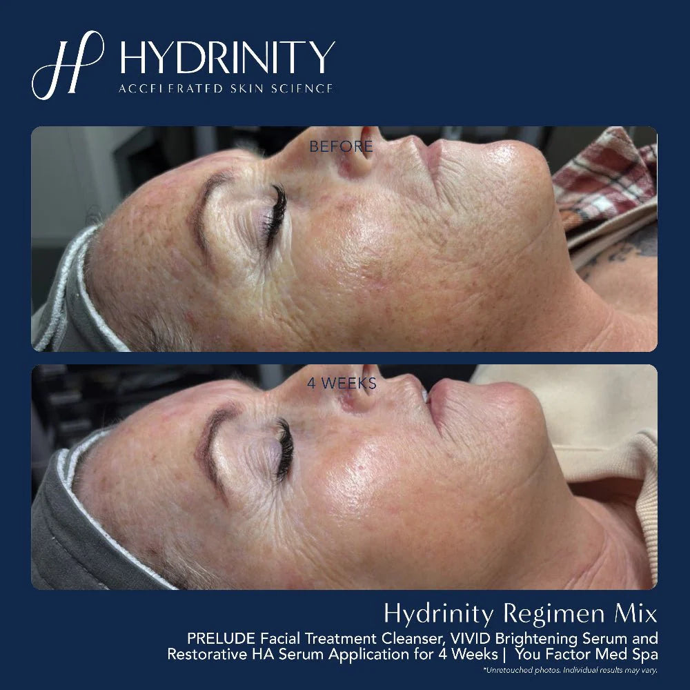 Hydrinity Vivid Brightening Serum
