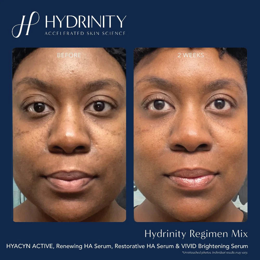Hydrinity Vivid Brightening Serum