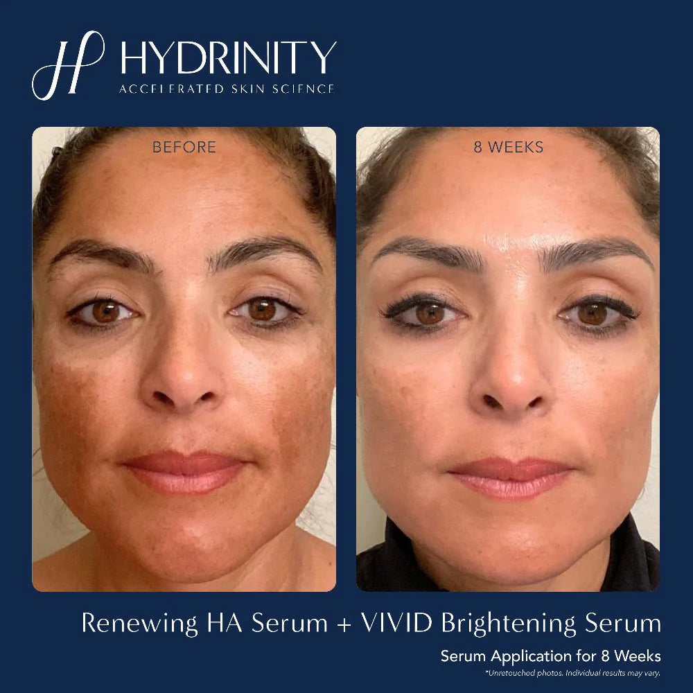 Hydrinity Vivid Brightening Serum