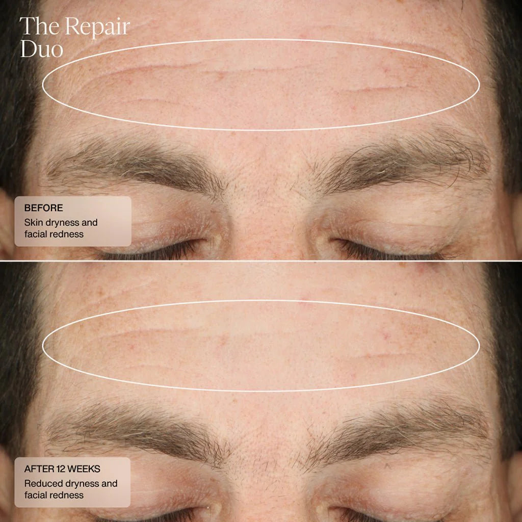 Senté Repair Duo Bundle Kits & Sets Senté