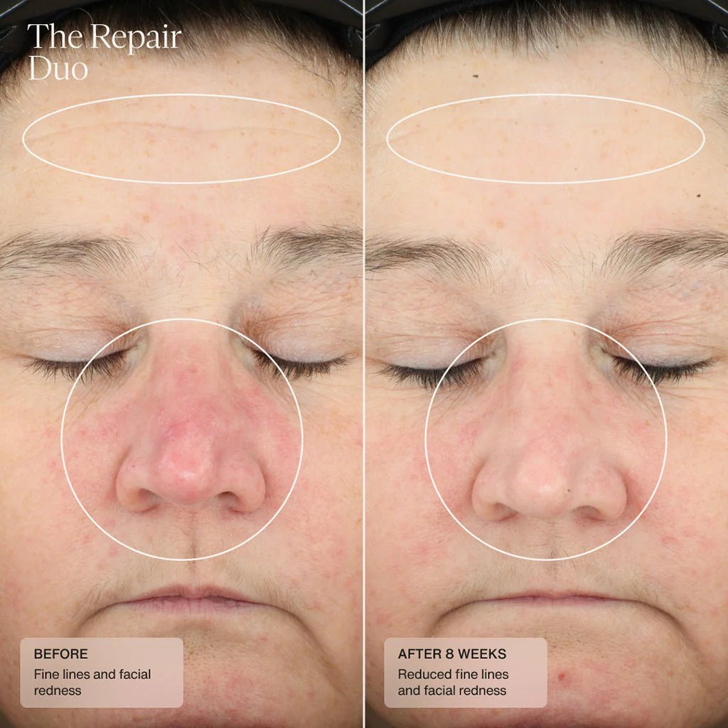 Senté Repair Duo Bundle Kits & Sets Senté