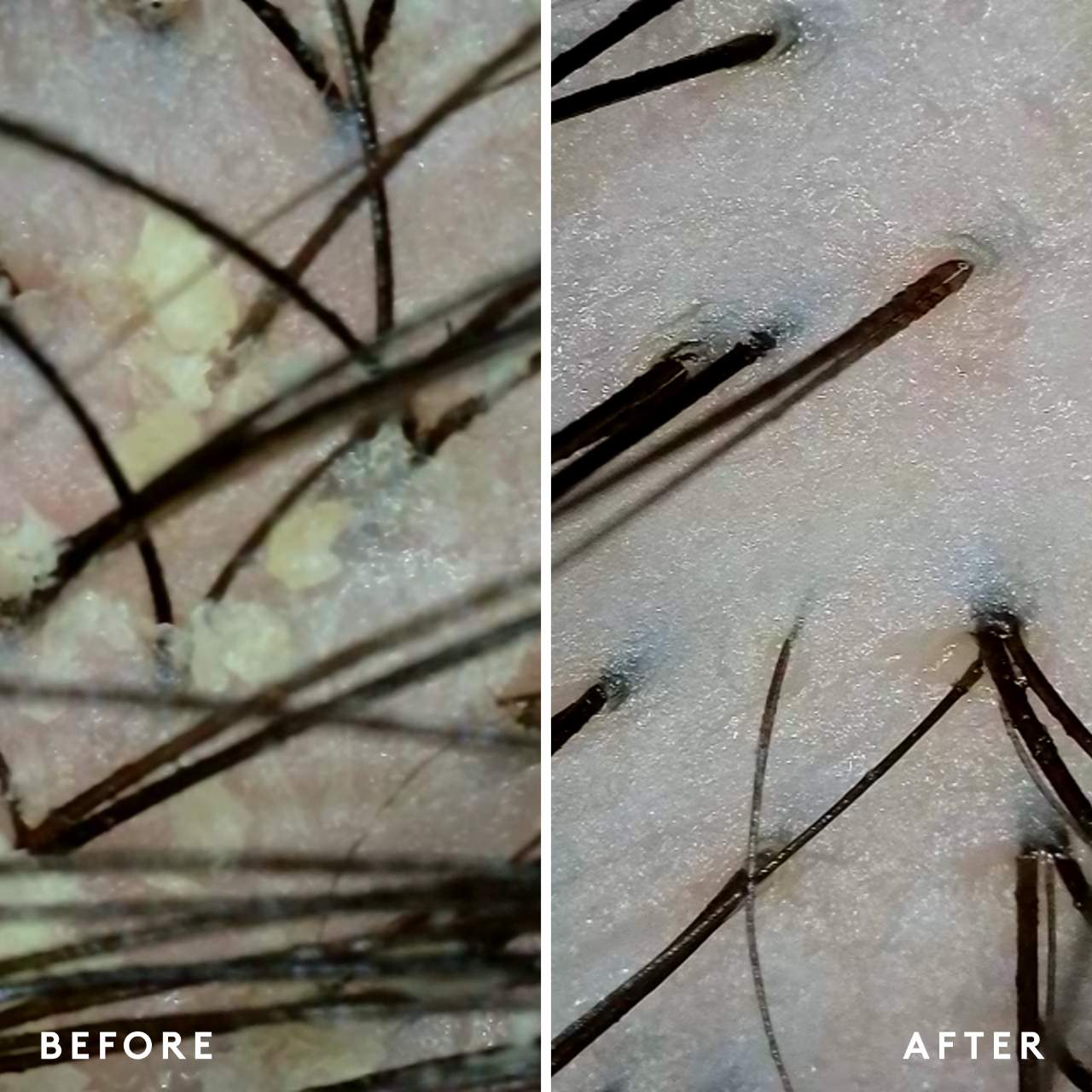 Virtue Scalp Remedy Shampoo Shampoo Virtue