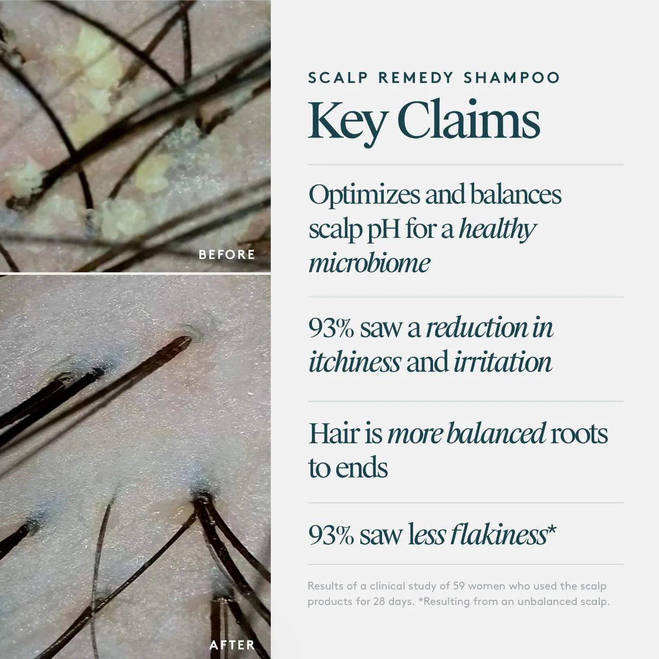 Virtue Scalp Remedy Shampoo Shampoo Virtue